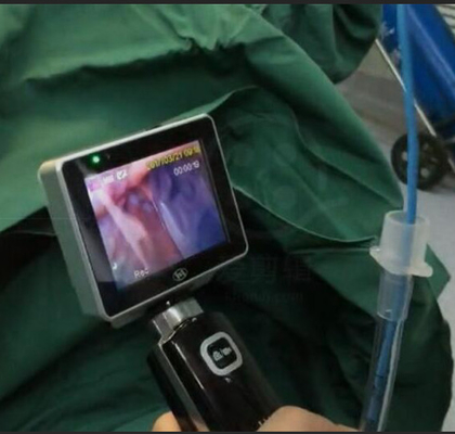 Интубации пользы ICU EMS Laryngoscope одиночной видео- с разрешением 1280 x 720 камер