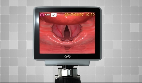 Laryngoscope 1320 пластикового оптического волокна металла HYHJ видео- с устранимыми лезвиями
