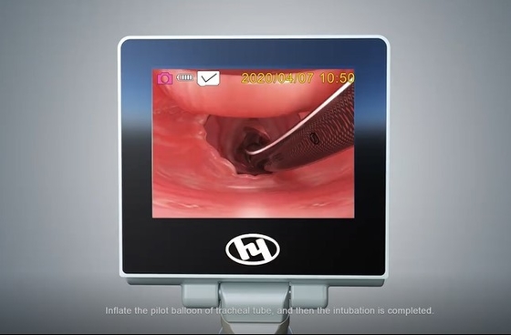Системы камеры тумана цифров металла Медицинск-степени HYHJ-KC Laryngoscope материальной анти- видео-