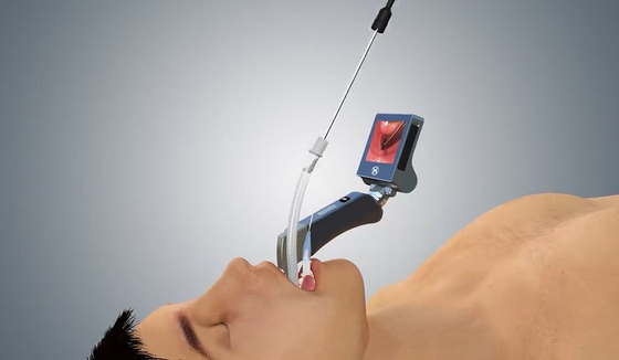 Laryngoscope 5 цифров лезвий Mac Miller медицинский видео- с эргономическим хвостовиком руки