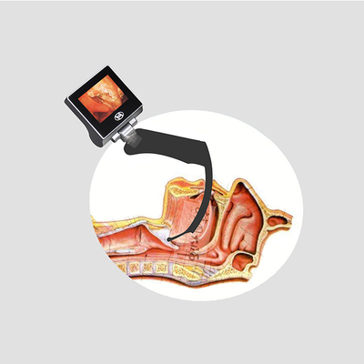 Отсутствие Borescope Laryngoscope Haiye камеры слепой области видео- для взрослых детей младенческих