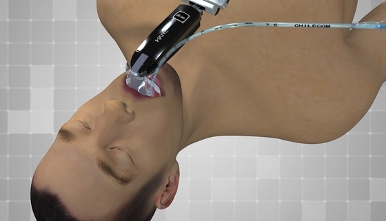 Usb Laryngoscope Ent электронного Endoscope больницы экрана 3,0 дюймов оптически вывел наружу