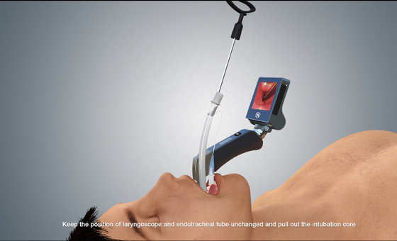 Laryngoscope ISO13485 Mcgrath многоразового оптического волокна лезвий видео-
