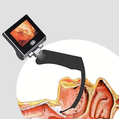 Laryngoscope многоразовой наркотизации LCD 360 градусов видео- 2 миллиона пиксел