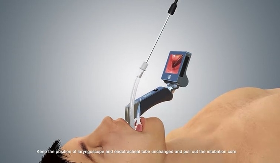 Системы камеры тумана цифров металла Медицинск-степени HYHJ-KC Laryngoscope материальной анти- видео-