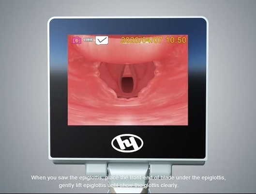 Laryngoscope ENT твердой наркотизации машины скорой помощи видео- с лезвием затруднения